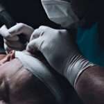 Hair Transplant