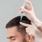 hair transplant cost London