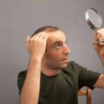 manual hair transplant London