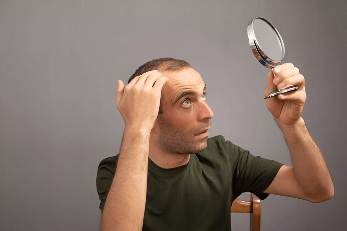 manual hair transplant London