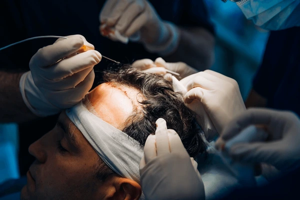 Hair Transplant