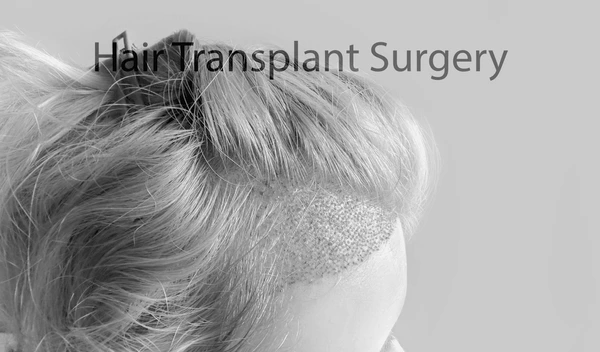 Hair Transplant