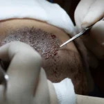 texture powder
