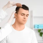 hairloss treatment